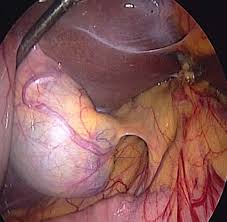 Gastroenterologist in Nashik